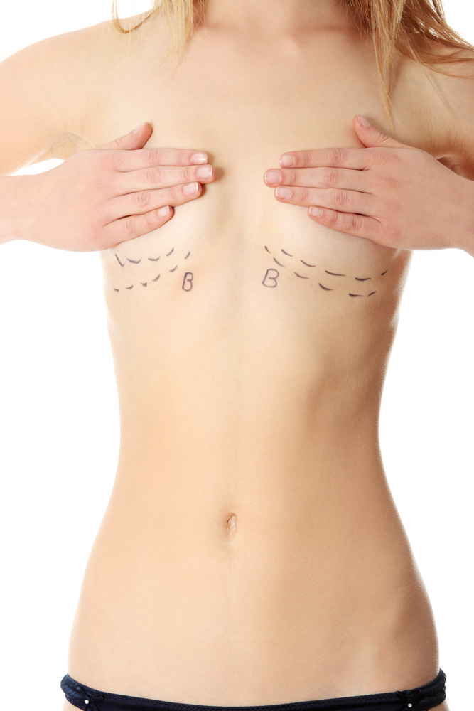 Breast Augmentation Surgery 115