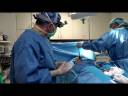 Dr Epstein - Breast Implant Removal and Revision in Chicago, IL